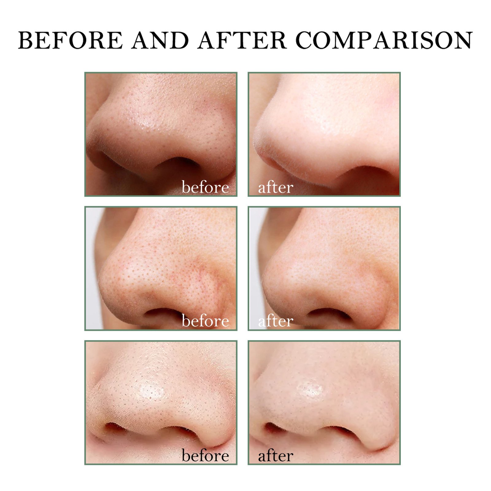 Volumette Complete Pore Kit (Blackhead Cream + 40 Pore Strips) - Image 2