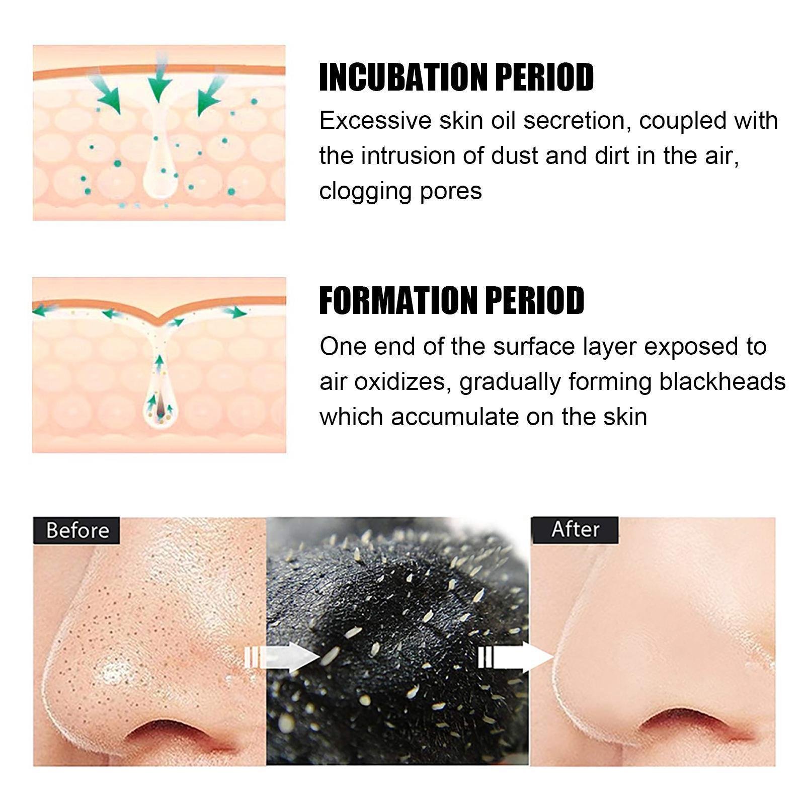 Volumette Pore-Refining Nose Strips - Image 4