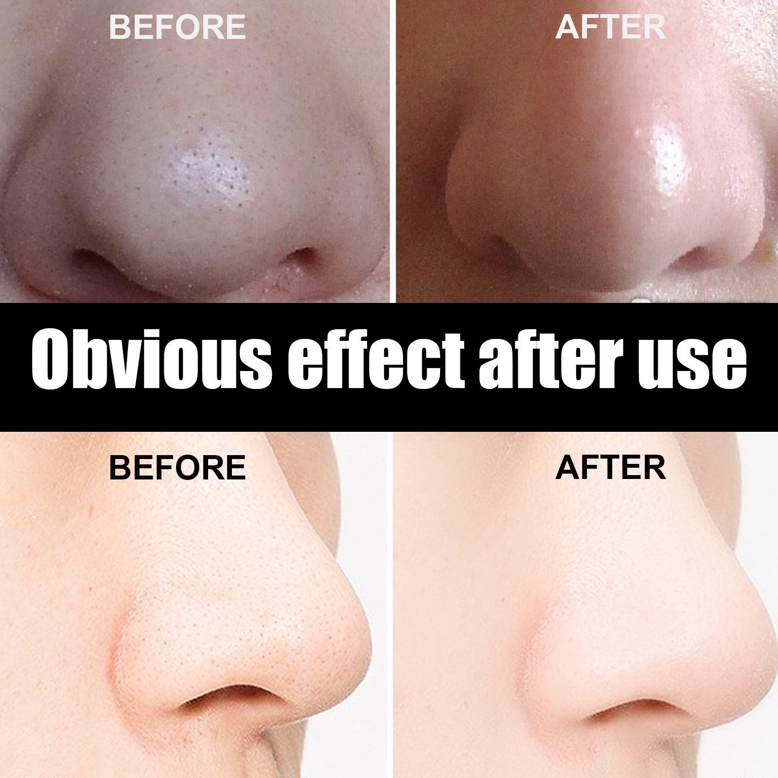 Volumette Pore-Refining Nose Strips - Image 6